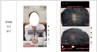 식약처, <SNS >  누리소통망 짧은 영상(숏폼) 콘텐츠 통한 허위·과대 집중점검